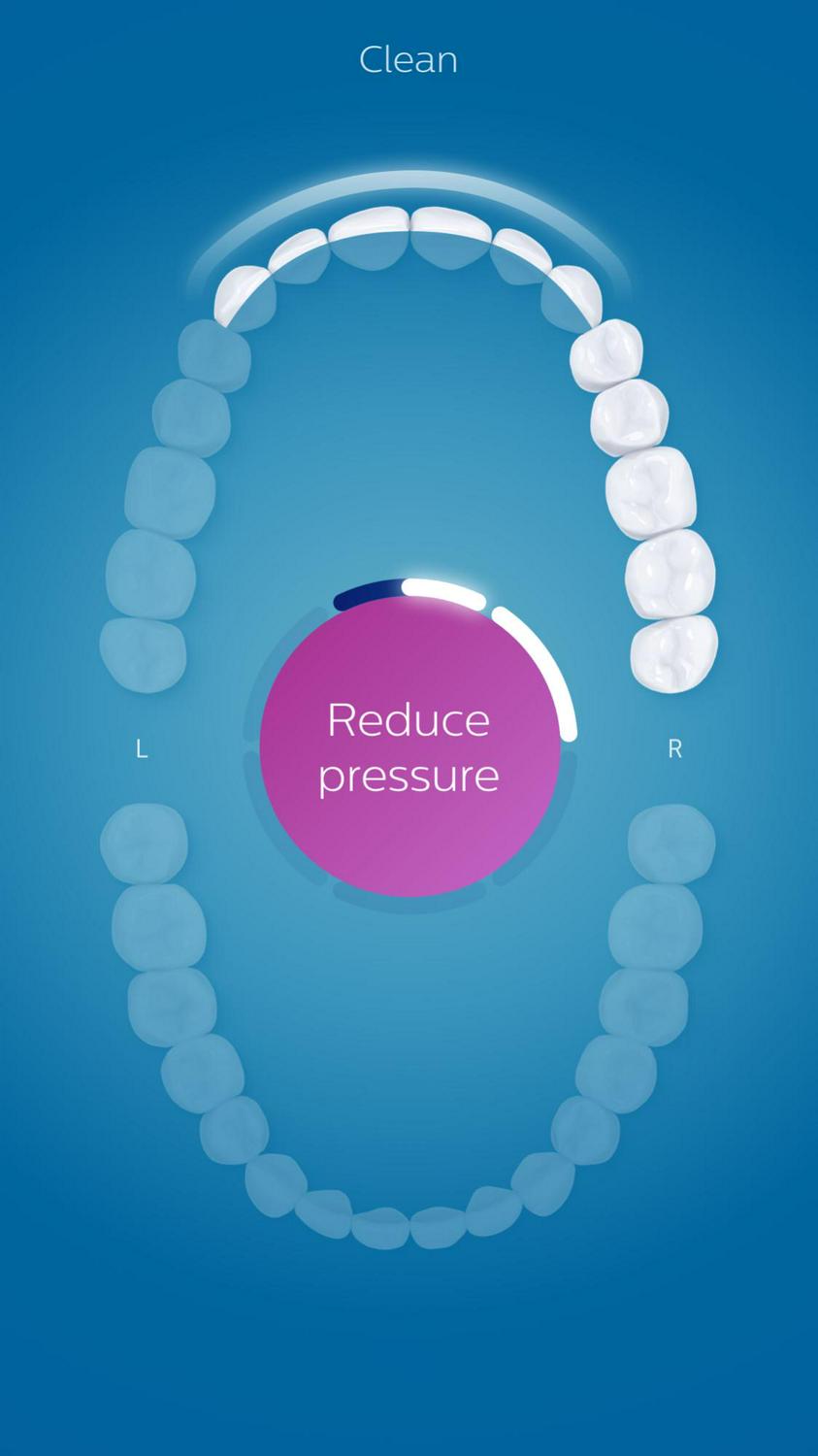 Philips Sonicare Diamondclean Smart Electric, Rechargeable Toothbrush For Complete Oral Care – 9300 Series, Pink, HX9903/21 - Image 13