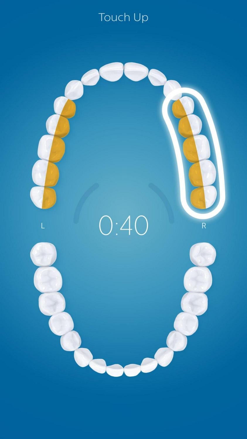 Philips Sonicare Diamondclean Smart Electric, Rechargeable Toothbrush For Complete Oral Care – 9300 Series, Pink, HX9903/21 - Image 7