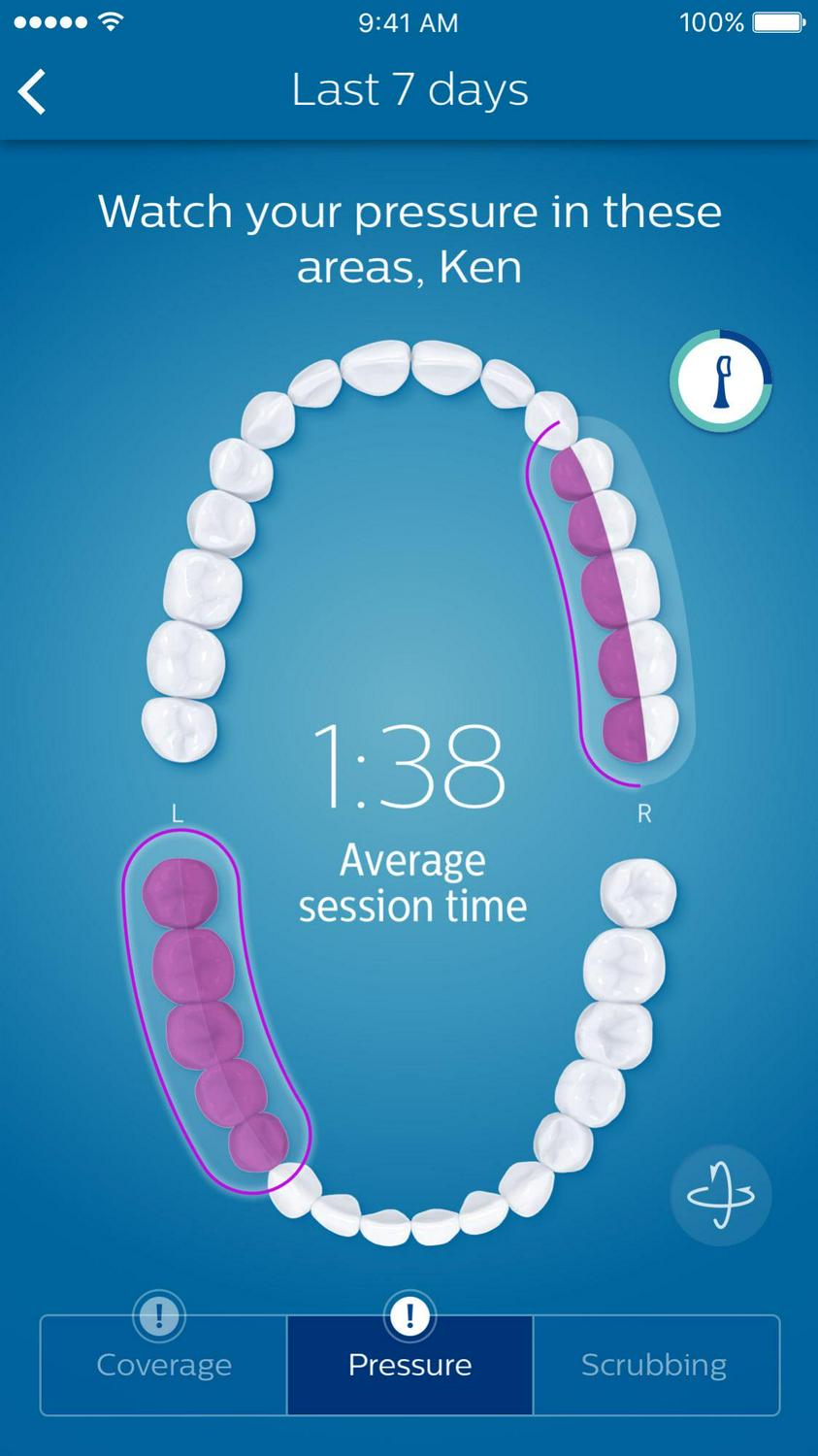 Philips Sonicare Diamondclean Smart Electric, Rechargeable Toothbrush For Complete Oral Care – 9300 Series, Pink, HX9903/21 - Image 8