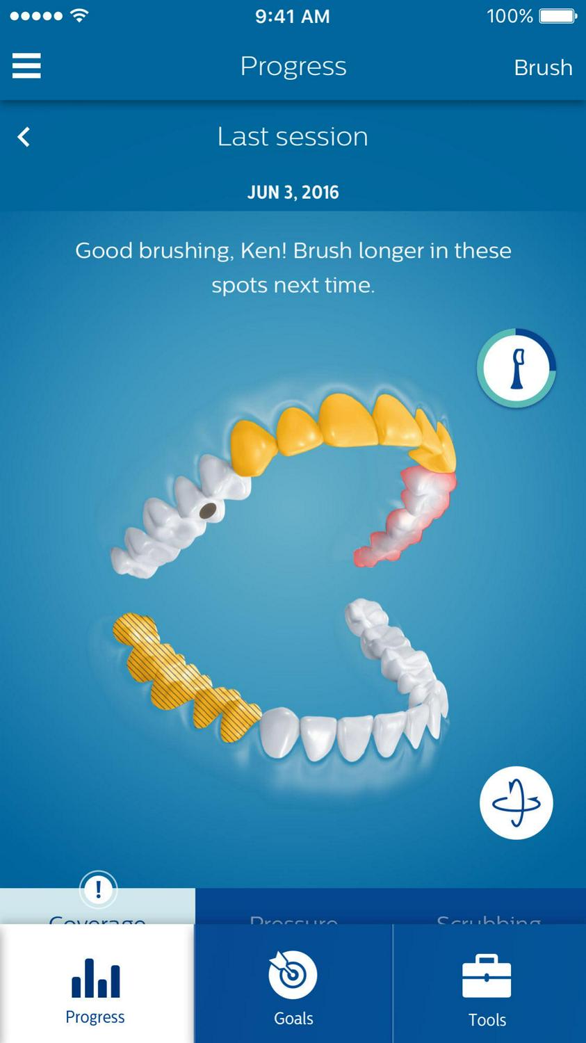 Philips Sonicare Diamondclean Smart Electric, Rechargeable Toothbrush For Complete Oral Care – 9300 Series, Pink, HX9903/21 - Image 12