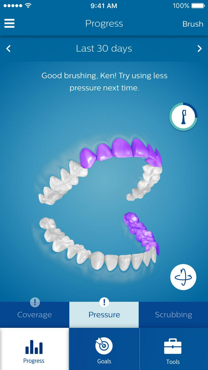 Philips Sonicare Diamondclean Smart Electric, Rechargeable Toothbrush For Complete Oral Care – 9300 Series, Pink, HX9903/21 - Image 10